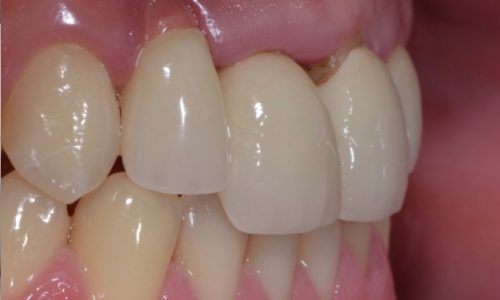 Estudio fotográfico previo